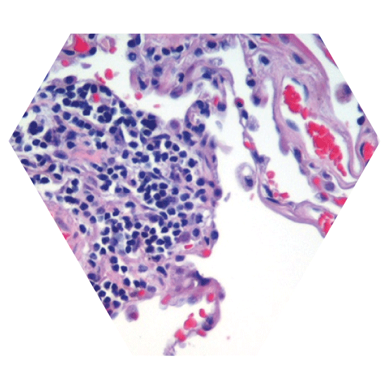 Cell microorganisms plasma treatment